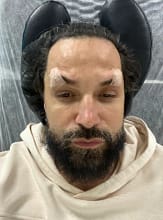 Instagram do cantor latino que fez um tratamento facial